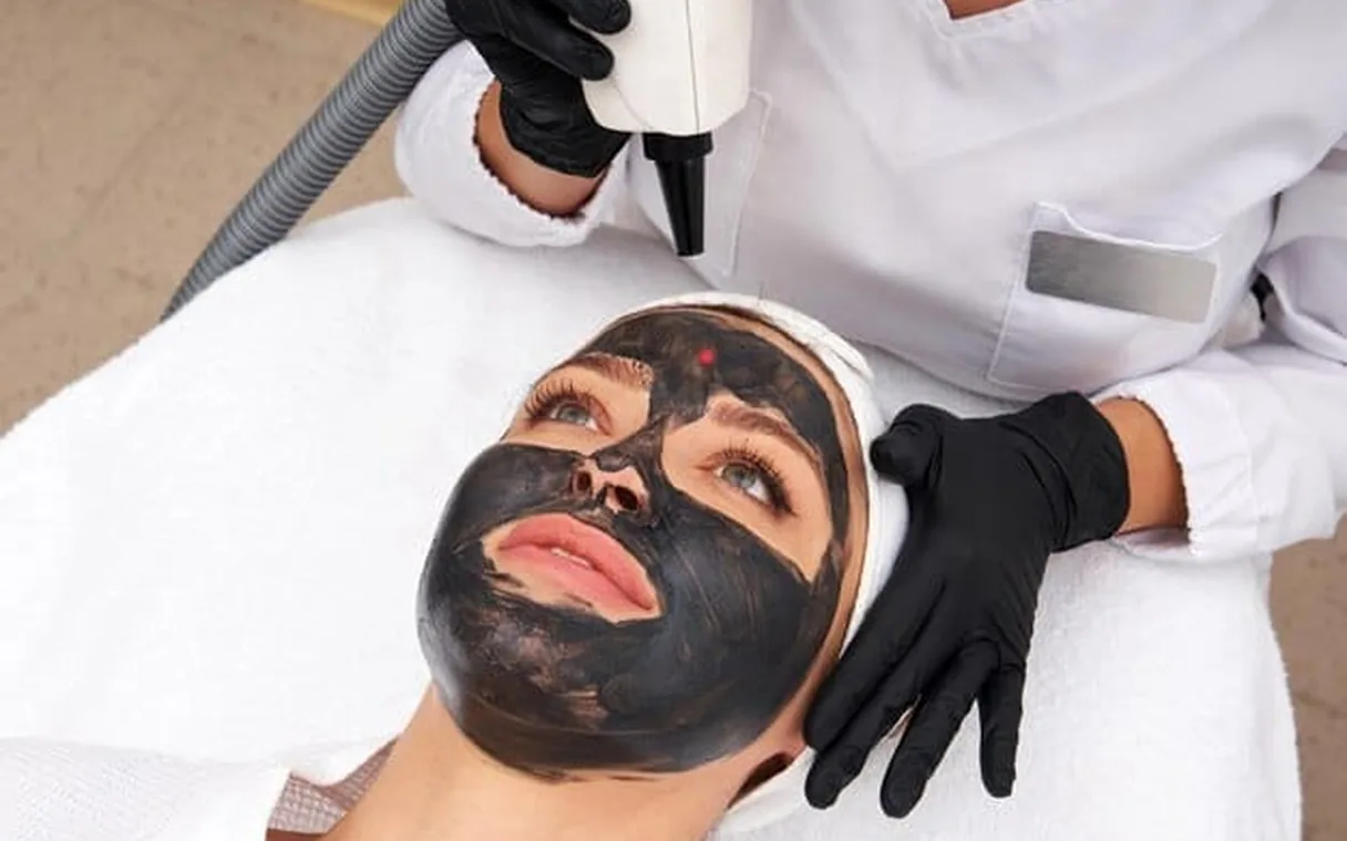 Carbon Laser Peel Before and After: 6-Week Results