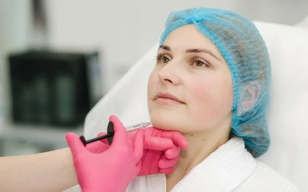 Thread Lift Before and After: How Long PDO Results Really Last